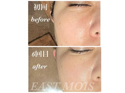 イーストモア(EAST MOIS)の写真