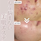 ニーナ ホワイトニングルーム(217whitening room)