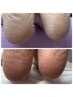 【全員】足裏ツルツルに☆足裏角質除去 ¥3500
