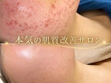オンフリーク(ONFREEK)の雰囲気(隠すためのファンデーションを卒業しませんか?)