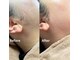 ここはなの写真/お顔の脱毛が気になる方へ♪【フェイシャル脱毛ワックス(90分)¥10,800→¥8,800】トーンアップ効果も◎