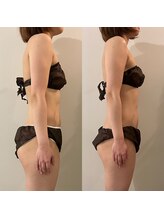 ラナ 京都西院店(Lana)/全身リンパマッサージ