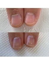 リコリサイア(ricco risaia)/最強のネイルケアで甘皮すっきり