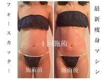 シェリラソワン(Che'rie La Soin)