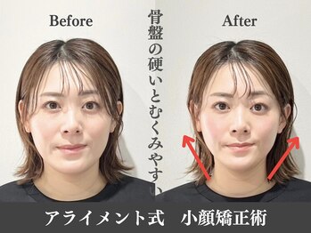 アライメントトウキョウ 表参道(Alignment TOKYO)/骨盤がむくみに関与♪