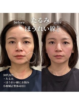 フェアリーフェイス 南森町店(Fairy Face)/南森町/小顔矯正/美容整体/腸