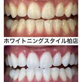 ホワイトニングスタイル 柏店