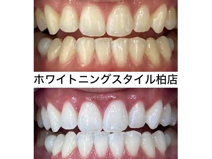 ホワイトニングスタイル 柏店の写真