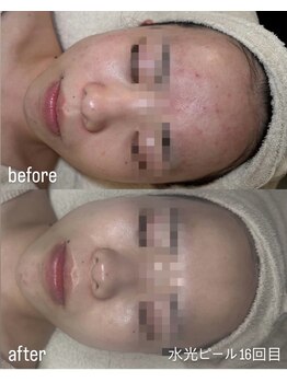 フロル(FLOR)/FLOR【根本改善専門店】