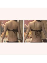 リリー ボヌール(Lily bonheur)/ソニック美腕トリートメント