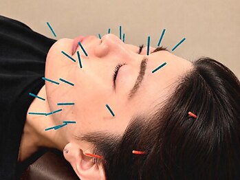 アネモネ 心斎橋院の写真/《全員女性美容鍼灸師/心斎橋駅徒歩5分》お化粧したまま美容鍼灸が受けられる◆痛みが少ない低刺激鍼