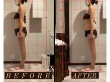 シストワ(sistoi)/《Before→After》