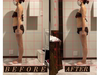 シストワ(sistoi)/《Before→After》