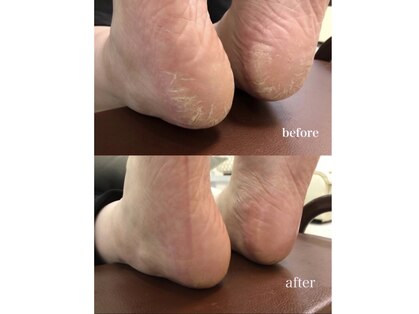 ゾゾ イリプレッセブル(ZOZO irreplaceable)の写真