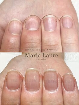 マリーロール 淀屋橋本店(Marie Laure)/自爪育成/深爪矯正/ネイルケア