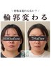 《新規》小顔頭蓋骨矯正＋リンパケア5回コース　￥38500→￥28500