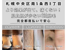 エースタイル 札幌店(a-style)/THR方式で効果抜群！