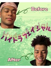 サロンジム(SalonGym)/ハイドラフェイシャル