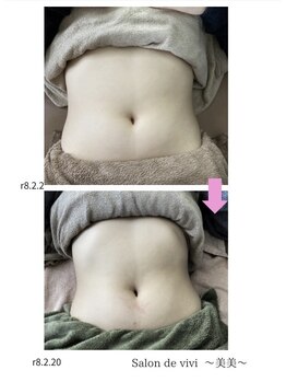 サロンド美美(Salon de vivi)/ウエストくびれダイエット期待