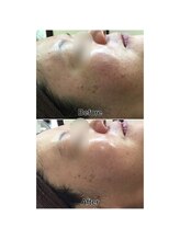 ドルフィン(Dolphin)/★お客様ビフォーアフター