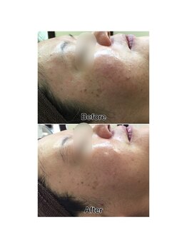 ドルフィン(Dolphin)/★お客様ビフォーアフター