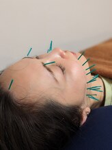 乃々鍼灸整体院 表参道/美容鍼