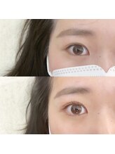 フランセス(Frances)/上下ラッシュリフト