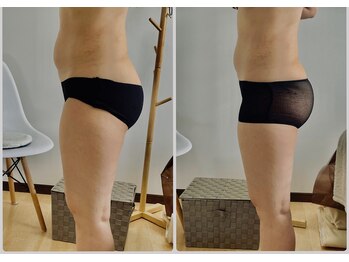 キレイノカタチ(Kirei No Katachi)/アーユルヴェーダトで痩身