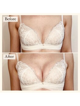 アンシャンテ(ENCHANTER)/光バストアップ