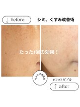 リオル(Rior)/フォトダブル