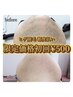 【脱毛】☆8月限定☆ ヒゲ全体破格の¥8,000→¥500！？