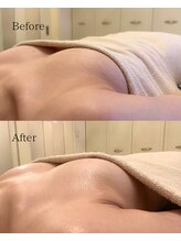 ボインラボ(Boin Labo)/ボインバストアップの力