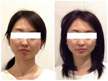 美容整体 ウェリナ 蟹江院/小顔矯正/骨盤矯正/美脚サロン 