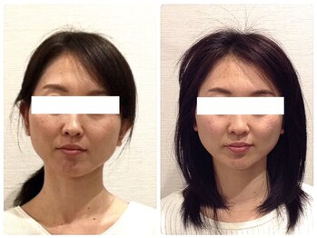 美容整体 ウェリナ 蟹江院/小顔矯正/骨盤矯正/美脚サロン