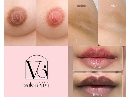 サロンヴィヴィ(salon ViVi)の写真