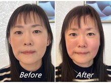 ドクターボディ 新宿店(Dr.Body)/【顔の歪み/左右差/長さ　50代】