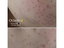 ピーエム(P.M)/全顔シミ透明感ケア