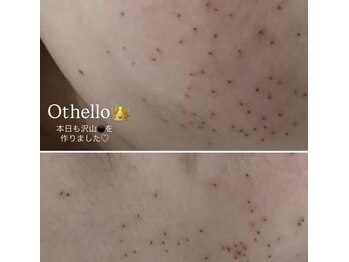 ピーエム(P.M)/全顔シミ透明感ケア