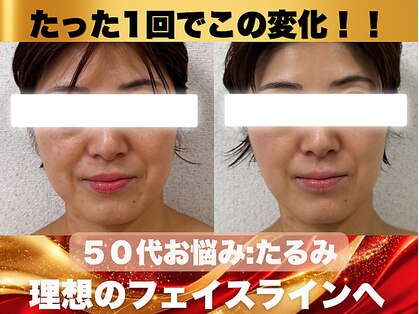 ナーナモエ(na-namoe)の写真