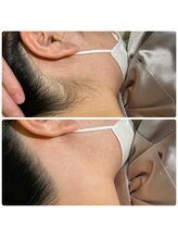 脱毛専門店 ハブ ア グッデイ(Have a good day!)/髪をまとめる前に！