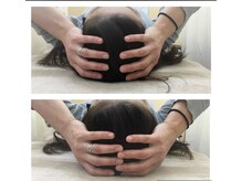 いきいき鍼灸整骨院/ヘッドセラピーafter