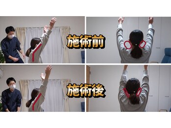 スタイルフリー/40代　肩こり