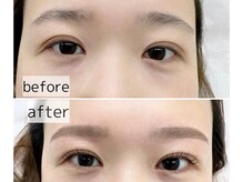 【施術2】ワックス　－肌負担を考えた商材使用ー