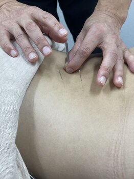 あゆみボディケアの写真/【用賀駅徒歩2分/NEWOPEN！】ベテラン施術者の技術で根本改善◎鍼が初めての方にもオススメ☆