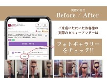 クイーン 札幌大通店(Queen)の雰囲気（気になる部分の引き締めやイベント前のお急ぎダイエットも◎痩身）