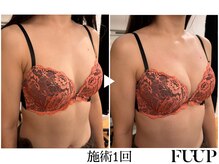 フーアップ 北千住(FU-UP)/バストアップ/育乳（1回）