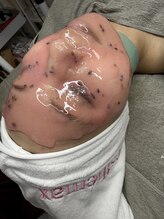 アレーズファイブフォー(A’LAISE54)/ハイドロジェリーマスク