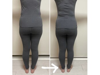 コルッソ(CoLusson.)/からだの歪み、癒着整えます