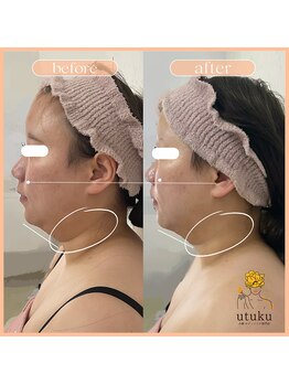 ウツク(utuku)/フェイシャル　長岡/柏崎/三条