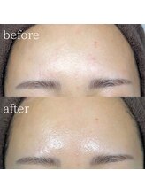 エメリーヌ(AIMELINE)/クリスティーナ　アンストレス